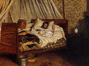 Frederic Bazille, Monet after His Accident at the Inn of Chailly